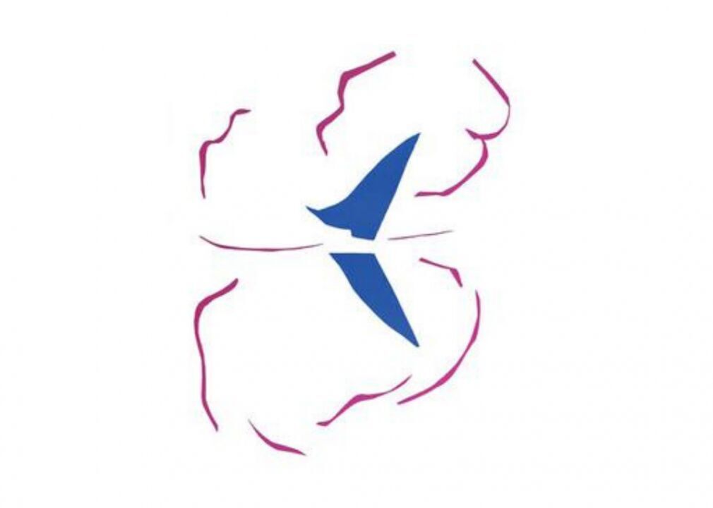 1961: Matisse collage displayed upside down